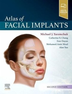 Atlas of Facial Implants - Yaremchuk, Michael J
