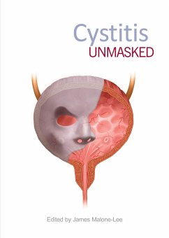 Cystitis Unmasked - Malone-Lee, James