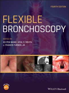 Cover Flexible Bronchoscopy (eBook, PDF)