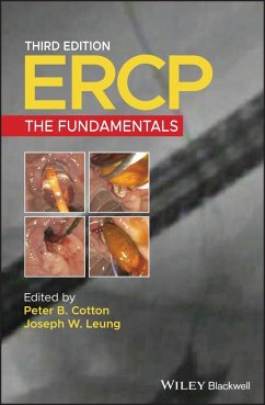 ERCP (eBook, ePUB)