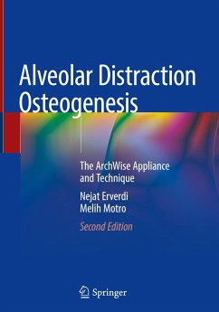 Alveolar Distraction Osteogenesis - Erverdi, Nejat;Motro, Melih