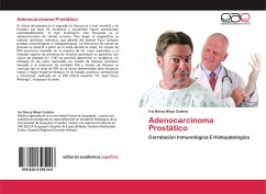 Adenocarcinoma Prostático - Moya Cedeño, Iris Nancy