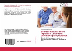 Sobredentaduras sobre implantes: una buena alternativa para pacientes