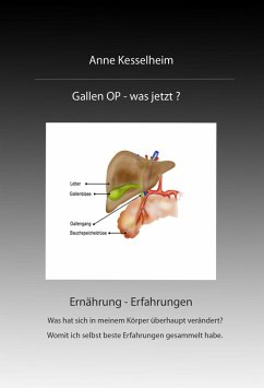 Gallen OP - was nun? (eBook, ePUB) - Kesselheim, Anne Gallen OP - was nun? (eBook, ePUB) - Kesselheim, Anne