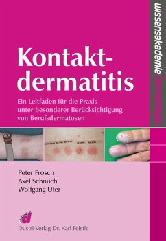 Cover Kontaktdermatitis (eBook, PDF)