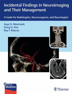 Incidental Findings in Neuroimaging and Their Management (eBook, PDF) - Westmark, Kaye D.; Kim, Dong H.; Riascos-Castaneda, Roy F.