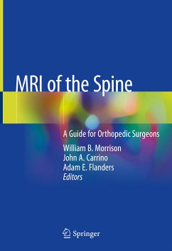 MRI of the Spine (eBook, PDF)