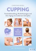 Cupping (eBook, ePUB)