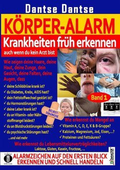 KÖRPER-ALARM - Krankheiten früh erkennen, auch wenn du kein Arzt bist! Band 1: (eBook, ePUB) - Dantse, Dantse