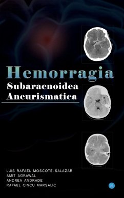 Cover Hemorragia Subaracnoidea Aneurismatica