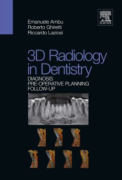 3D Radiology in Dentistry (eBook, ePUB) - Ambu, Emanuele; Ghiretti, Roberto; Laziosi, Riccardo