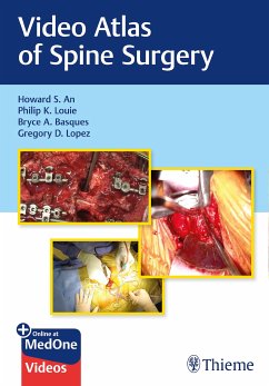 Video Atlas of Spine Surgery (eBook, PDF) - An, Howard S.; Louie, Philip K.; Basques, Bryce; Lopez, Gregory