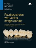 Fixed prosthesis with vertical margin closure (eBook, ePUB)