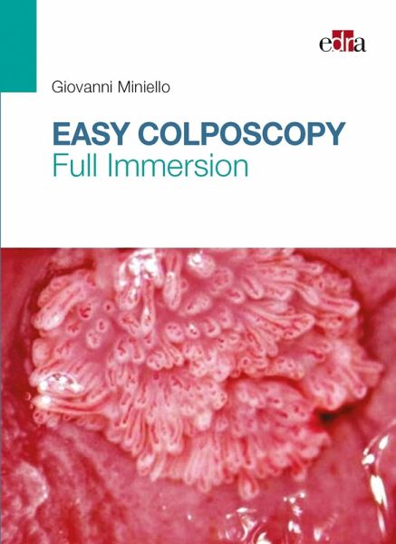 Easy Colposcopy (eBook, ePUB) Easy Colposcopy (eBook, ePUB)