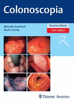 Cover Colonoscopia (eBook, ePUB)