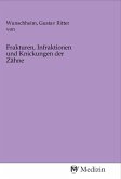 Frakturen, Infraktionen und Knickungen der Zähne