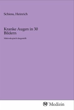 Kranke Augen in 30 Bildern