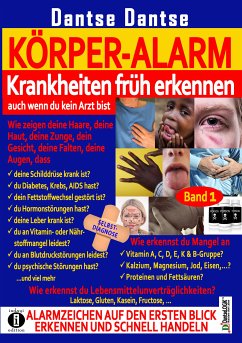 Körper-Alarm: Krankheiten früh erkennen, auch wenn du kein Arzt bist! (eBook, ePUB) - Dantse, Guy