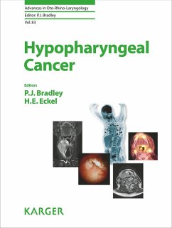 Hypopharyngeal Cancer (eBook, ePUB)