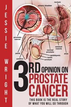 3rd Opinion on Prostate Cancer - Wright, Jessie