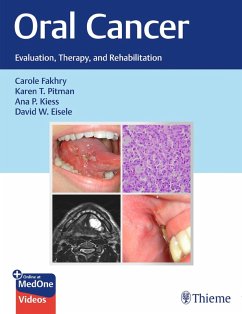 Cover Oral Cancer (eBook, PDF)