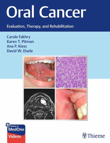 Oral Cancer (eBook, PDF)