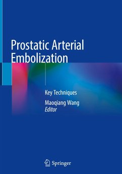 Prostatic Arterial Embolization