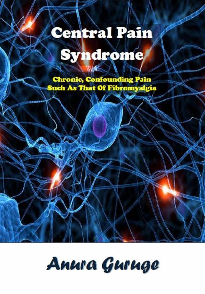 Central Pain Syndrome (eBook, ePUB)