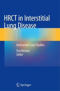 HRCT in Interstitial Lung Disease