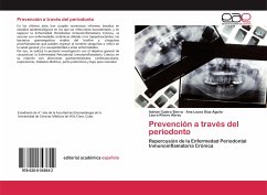 Prevención a través del periodonto - Castro Sierra, Adrian;Díaz Águila, Ana Laura;Rivero Abreu, Laura