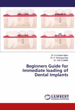 Beginners Guide for Immediate loading of Dental Implants - Babu, K. A. Saran;Rao, P. Srinivasa;Kumar, V. C. H.