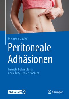 Peritoneale Adhäsionen (eBook, PDF) - Liedler, Michaela