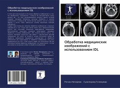 Obrabotka medicinskih izobrazhenij s ispol'zowaniem IDL - Nataraqn, Rathan;Gopakumar, Sunilkumar