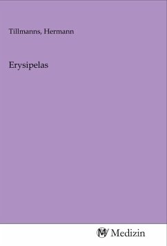 Erysipelas