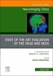 State of the Art Evaluation of the Head... - Bild 1