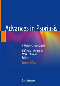 Advances in Psoriasis