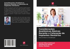 Considerações Anatômicas Básicas Durante a Colocação de Implantes Dentários - Gaikwad, Sonali Vikas; Dange, Shankarrao; Mahale, Kishor