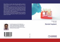 Dental Implant - Gupta, Prabhakar;Gupta, Tanu