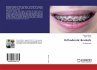 Orthodontic Brackets - Bild 1