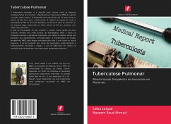 Tuberculose Pulmonar - Laique, Talha; Saud Ahmad, Naseem