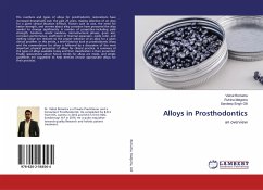 Alloys in Prosthodontics