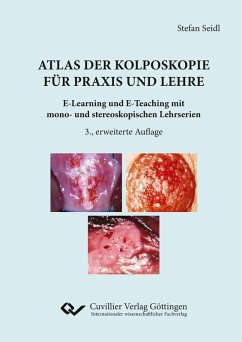 Atlas der Kolposkopie für Praxis und Lehre (eBook, PDF)