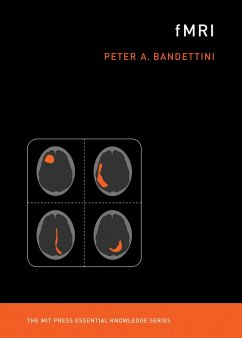 fMRI (eBook, ePUB) - Bandettini, Peter A.