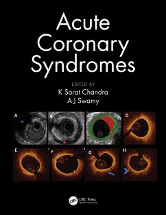 Cover Acute Coronary Syndromes (eBook, ePUB)