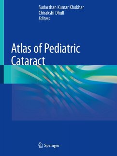 Atlas of Pediatric Cataract