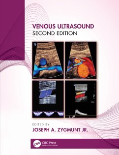 Cover Venous Ultrasound (eBook, ePUB)
