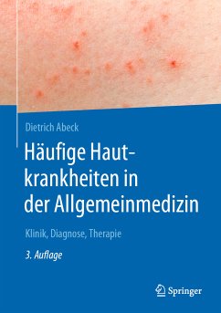 Häufige Hautkrankheiten in der Allgemeinmedizin (eBook, PDF) - Abeck, Dietrich