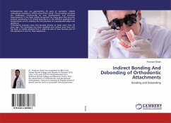 Indirect Bonding And Debonding of Orthodontic Attachments