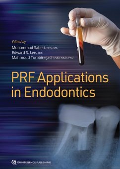 PRF Applications in Endodontics (eBook, ePUB) - Sabeti, Mohammad; Lee, Edward S; Torabinejad, Mahmoud