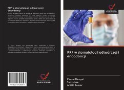 PRF w stomatologii odtwórczej i endodoncji - Mangat, Panna; Jose, Tony; Tomer, Anil K.